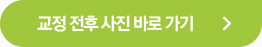 교정 전후 사진 바로 가기